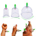 Anatomical Suction Cup Kit w/ 3 